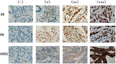 Associations Between Serum Reproductive Hormone Concentrations and Hormonal Receptor Status Among Postmenopausal Chinese Women With Breast Cancer: An Observational Study